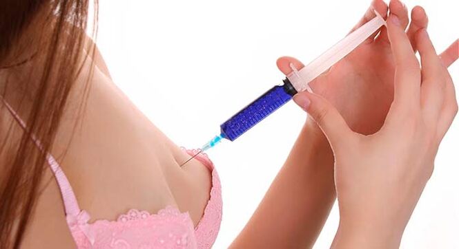 Mărirea sânilor cu injecții cu acid hialuronic